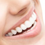 Dental Crown Process in Napier Area