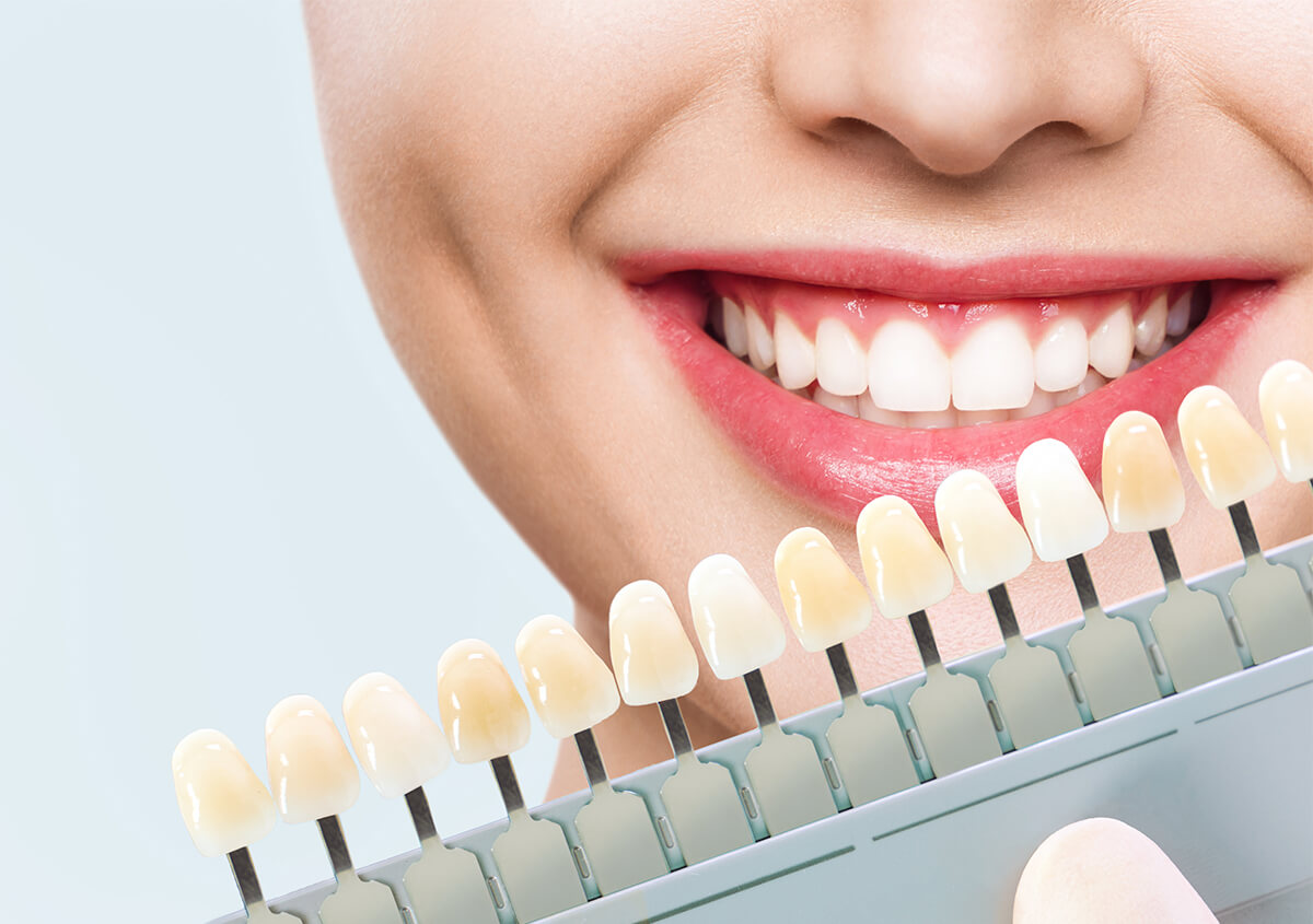 Correct Smile Imperfections with Porcelain Veneers